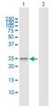 Transmembrane P24 Trafficking Protein 6 antibody, H00146456-B01P, Novus Biologicals, Western Blot image 