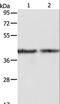 Aldolase, Fructose-Bisphosphate A antibody, LS-C403809, Lifespan Biosciences, Western Blot image 