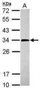 Purine Nucleoside Phosphorylase antibody, GTX117364, GeneTex, Western Blot image 