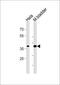 Eukaryotic Translation Initiation Factor 3 Subunit H antibody, MBS9207033, MyBioSource, Western Blot image 