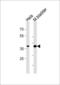 Eukaryotic Translation Initiation Factor 3 Subunit H antibody, MBS9207033, MyBioSource, Western Blot image 