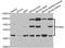 Nogo-66 receptor antibody, TA332956, Origene, Western Blot image 