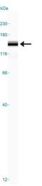 Lysine-specific demethylase 4A antibody, NBP1-49602, Novus Biologicals, Western Blot image 