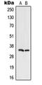 Uracil-DNA glycosylase antibody, MBS821775, MyBioSource, Western Blot image 