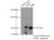 Inositol-Trisphosphate 3-Kinase C antibody, 14267-1-AP, Proteintech Group, Immunoprecipitation image 