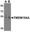 Transmembrane Protein 184A antibody, A14566, Boster Biological Technology, Western Blot image 