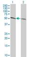 Tubulin Alpha 4a antibody, H00007277-M06, Novus Biologicals, Western Blot image 