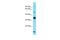 NUS1 Dehydrodolichyl Diphosphate Synthase Subunit antibody, A08264, Boster Biological Technology, Western Blot image 