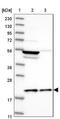 Mitochondrial Ribosomal Protein L18 antibody, NBP1-83176, Novus Biologicals, Western Blot image 