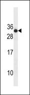 Ras-related protein Rab-4B antibody, PA5-49124, Invitrogen Antibodies, Western Blot image 