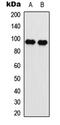 Eukaryotic Translation Elongation Factor 2 antibody, abx121387, Abbexa, Western Blot image 