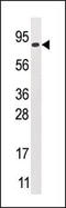 Mannosyl-Oligosaccharide Glucosidase antibody, AP12152PU-N, Origene, Western Blot image 