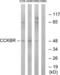 Cholecystokinin B Receptor antibody, LS-C120565, Lifespan Biosciences, Western Blot image 