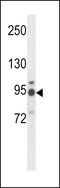 Alpha-1,6-Mannosylglycoprotein 6-Beta-N-Acetylglucosaminyltransferase antibody, LS-C164175, Lifespan Biosciences, Western Blot image 