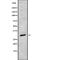 Oligodendrocyte Transcription Factor 2 antibody, abx217495, Abbexa, Western Blot image 