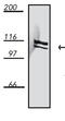 Dynamin 1 antibody, GTX14448, GeneTex, Western Blot image 