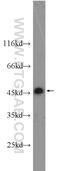 NSFL1 Cofactor antibody, 15620-1-AP, Proteintech Group, Western Blot image 