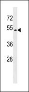 G Protein-Coupled Receptor 171 antibody, 58-887, ProSci, Western Blot image 