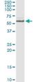 Inositol Polyphosphate-5-Phosphatase A antibody, H00003632-M05, Novus Biologicals, Immunoprecipitation image 