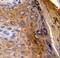 Keratin 10 antibody, LS-C165613, Lifespan Biosciences, Immunohistochemistry frozen image 