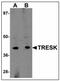 Potassium Two Pore Domain Channel Subfamily K Member 18 antibody, AP23931PU-N, Origene, Western Blot image 