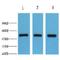 Fumarate Hydratase antibody, LS-C387486, Lifespan Biosciences, Western Blot image 