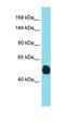 Transmembrane Serine Protease 3 antibody, orb331325, Biorbyt, Western Blot image 