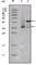 Estrogen Receptor 1 antibody, abx010735, Abbexa, Western Blot image 