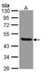 Interleukin 1 Receptor Type 2 antibody, TA308544, Origene, Western Blot image 