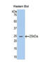 Acetylcholinesterase antibody, LS-C292585, Lifespan Biosciences, Western Blot image 