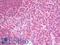 Proteasome Subunit Beta 9 antibody, LS-B10017, Lifespan Biosciences, Immunohistochemistry paraffin image 