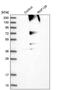 Ring Finger Protein 139 antibody, PA5-51534, Invitrogen Antibodies, Western Blot image 