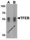 Transcription Factor EB antibody, 6801, ProSci, Western Blot image 