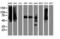 IlvB Acetolactate Synthase Like antibody, M15029, Boster Biological Technology, Western Blot image 