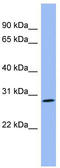 Proenkephalin-A antibody, TA345157, Origene, Western Blot image 