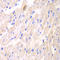 Tyrosine 3-Monooxygenase/Tryptophan 5-Monooxygenase Activation Protein Theta antibody, LS-C335254, Lifespan Biosciences, Immunohistochemistry frozen image 