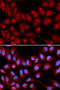 Interleukin 16 antibody, STJ24167, St John