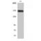 Colony Stimulating Factor 1 Receptor antibody, LS-C382687, Lifespan Biosciences, Western Blot image 