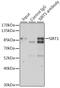 Sirtuin 1 antibody, GTX17532, GeneTex, Immunoprecipitation image 