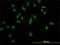 Lymphoid Enhancer Binding Factor 1 antibody, H00051176-M04, Novus Biologicals, Immunofluorescence image 