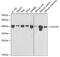 Cell Division Cycle 25C antibody, 13-986, ProSci, Western Blot image 