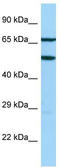 ArfGAP With FG Repeats 2 antibody, TA332045, Origene, Western Blot image 