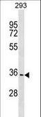 Phenazine Biosynthesis Like Protein Domain Containing antibody, LS-C158542, Lifespan Biosciences, Western Blot image 