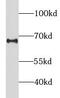 Leukocyte Immunoglobulin Like Receptor B5 antibody, FNab04778, FineTest, Western Blot image 