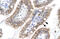 AE Binding Protein 1 antibody, 27-373, ProSci, Enzyme Linked Immunosorbent Assay image 
