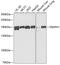 Diaphanous Related Formin 1 antibody, 19-849, ProSci, Western Blot image 