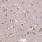 Transcription Factor AP-2 Delta antibody, NBP2-13428, Novus Biologicals, Immunohistochemistry frozen image 