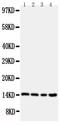 Cystatin-B antibody, PA5-79082, Invitrogen Antibodies, Western Blot image 