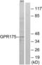 Transmembrane Protein Adipocyte Associated 1 antibody, LS-C120620, Lifespan Biosciences, Western Blot image 