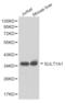 Sulfotransferase Family 1A Member 1 antibody, abx001346, Abbexa, Western Blot image 